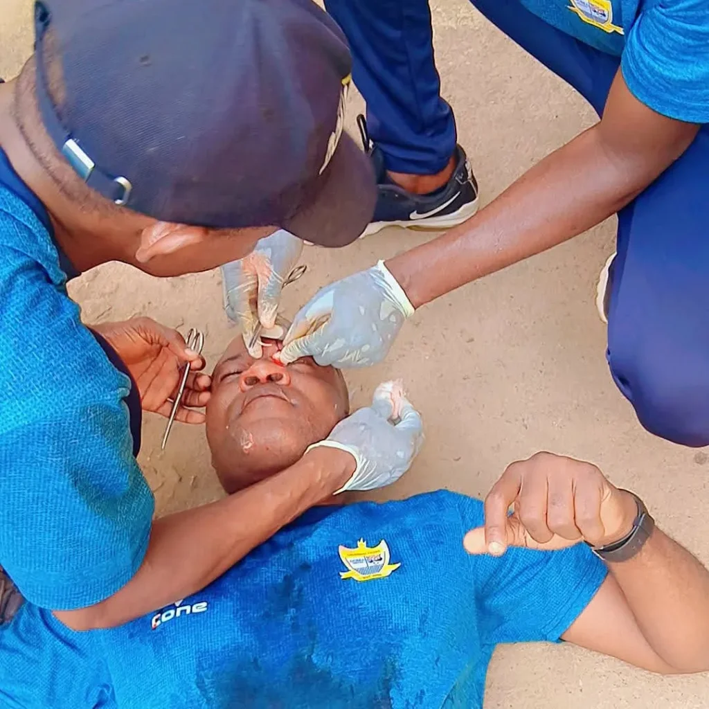 Doma United goalkeeper trainer left in coma on the field