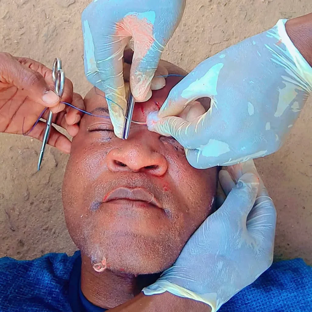 Doma United goalkeeper trainer receiving stiches