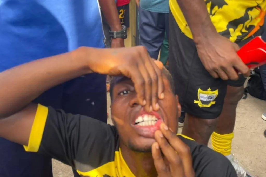 injured Doma United player after promotion